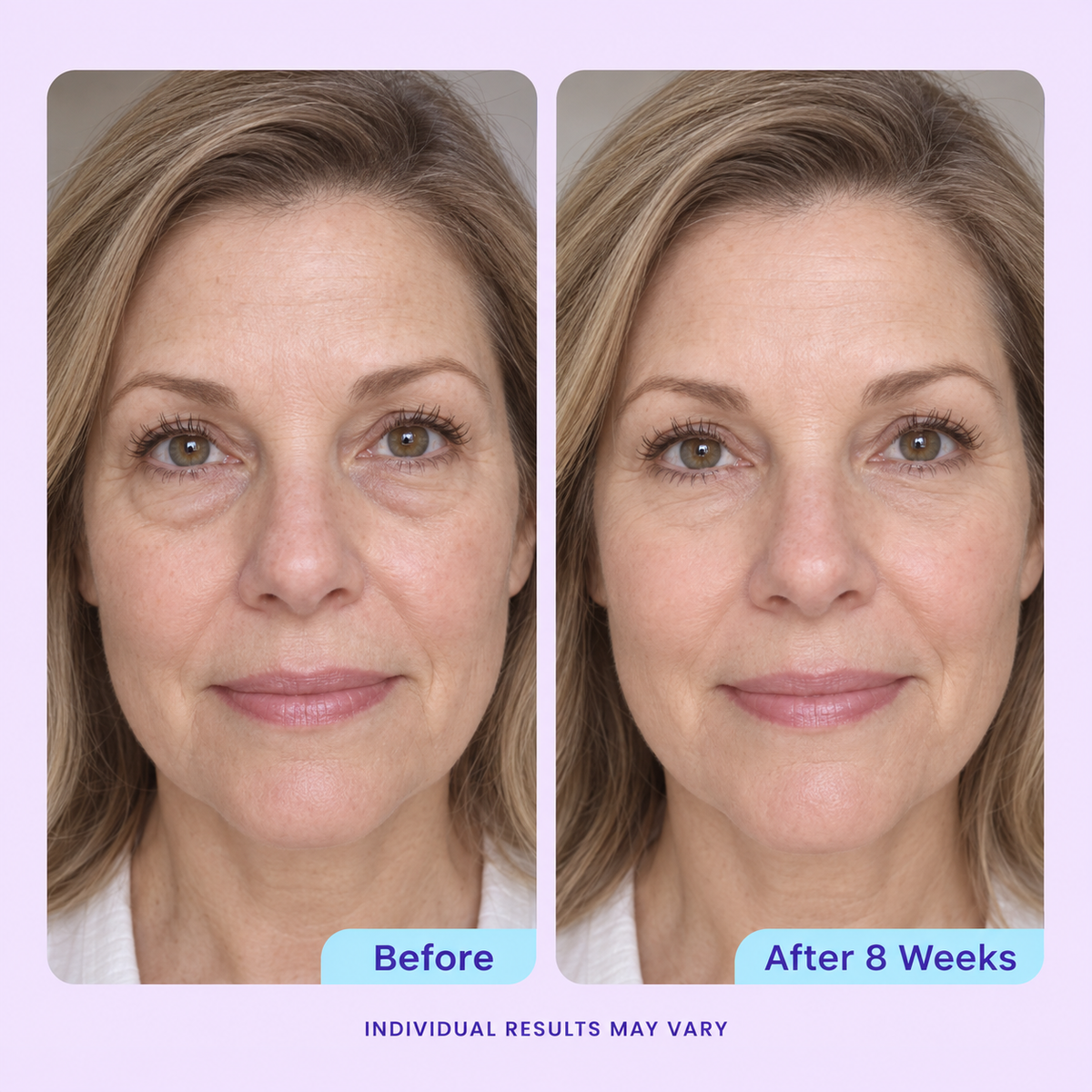 Instant Lift Eye Gel